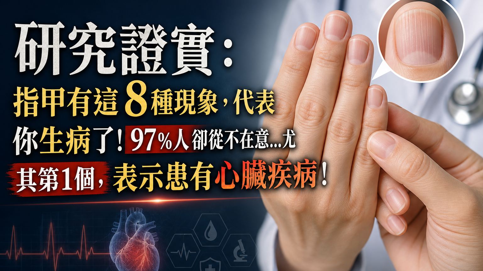 研究證實：指甲有這 8 種現象，代表你生病了！97％人卻從不在意…尤其第1個，表示患有心臟疾病！