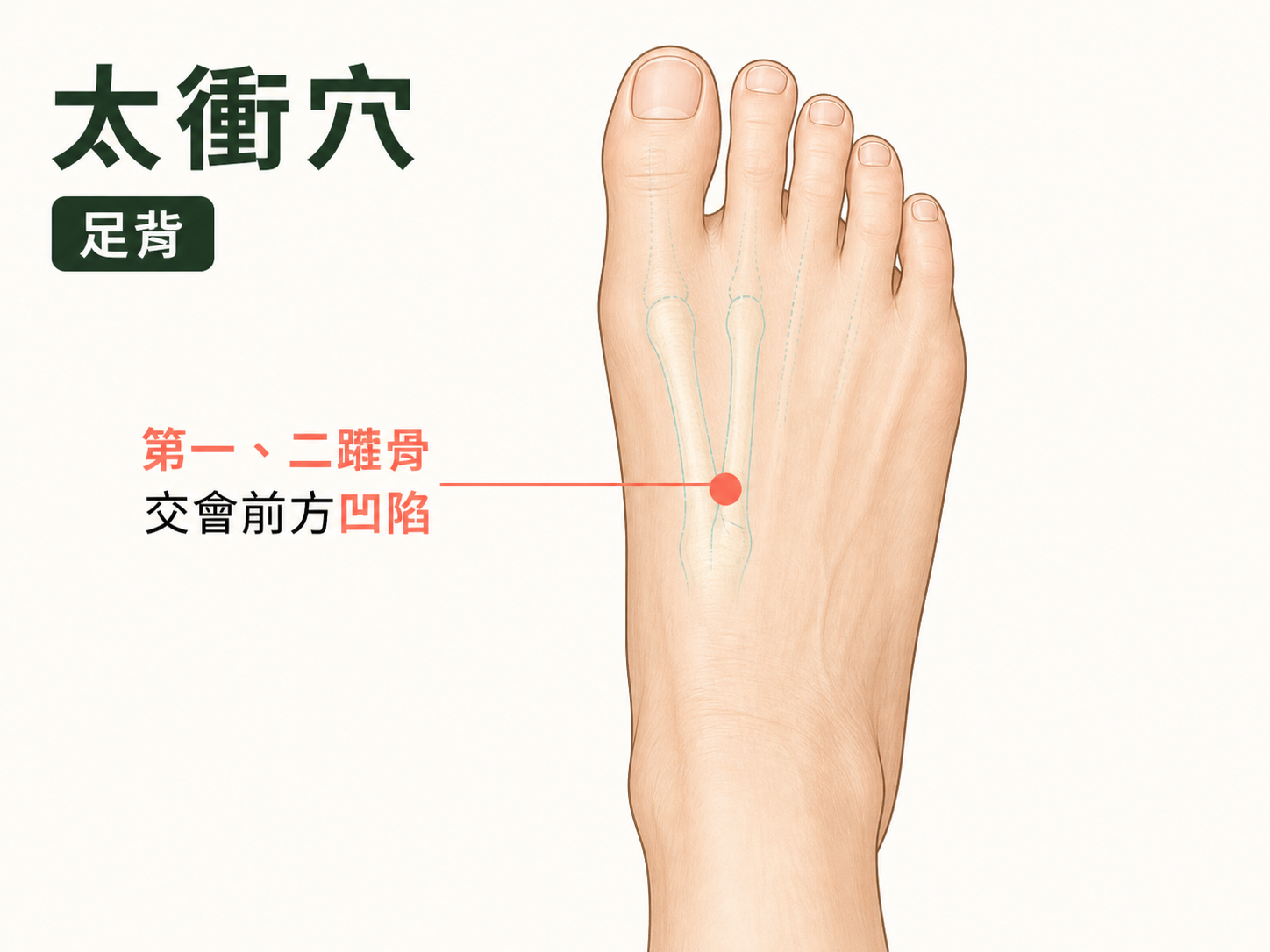 太衝穴位置示意圖：足背第一、二蹠骨交會前方凹陷