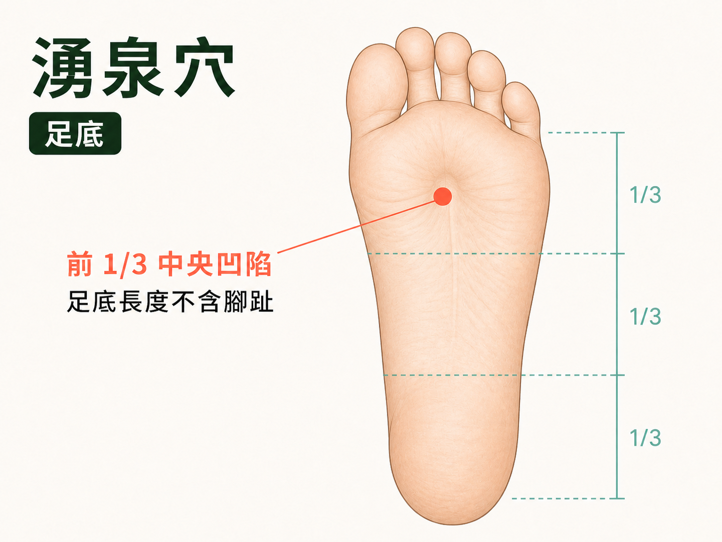 湧泉穴位置示意圖：足底前段中央凹陷